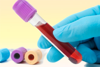 Анализ крови на иммуноглобулины Анализ крови на иммуноглобулины