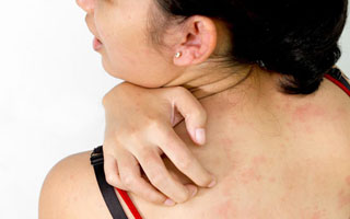 Сильный зуд Симптомы болезни