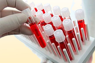 Общеклинический анализ крови Общеклинический анализ крови