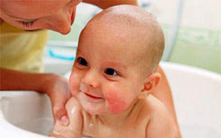 Атопический дерматит у ребенка Атопический дерматит