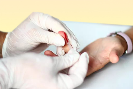 Взятие крови на анализ Забор крови